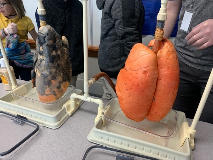 A close up of pig lungs with and without exposure to cigarettes. 